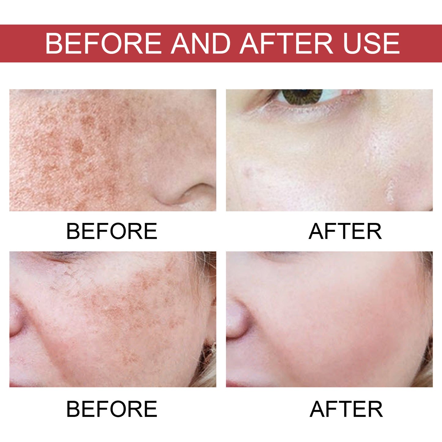 Hoygi™ GlowRepair Niacinamide + TXA Serum | Brightening Essence